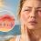 Allergie au soleil : que faire face à un visage gonflé ?
